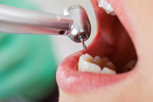 Fast & Reliable Emergency Dental Services in UT